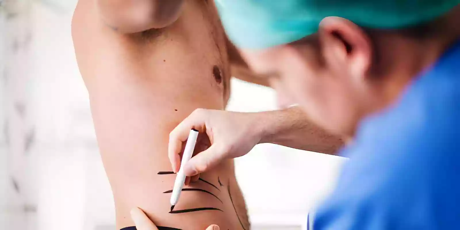 Ultrasound-assisted Vaser liposuction technique in Antalya