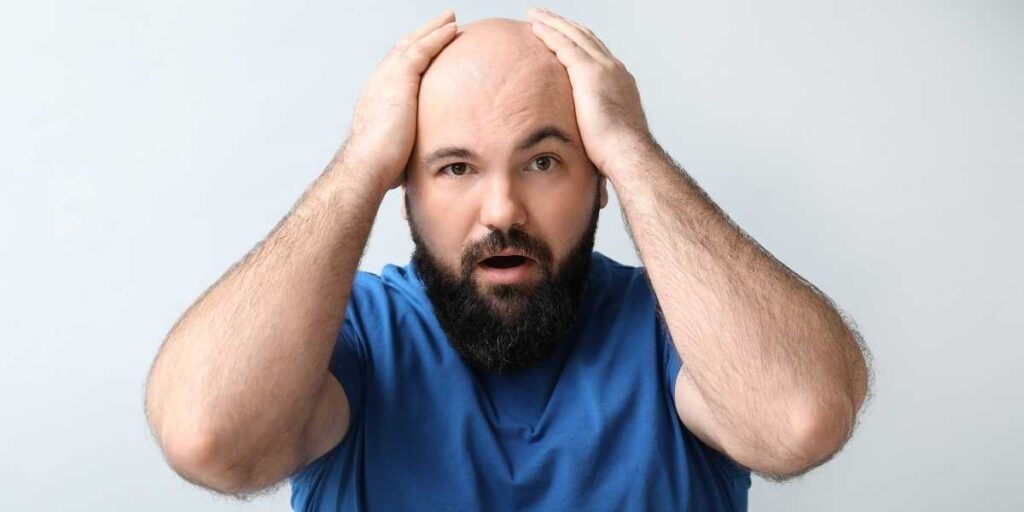 Shock Loss After Hair Transplant