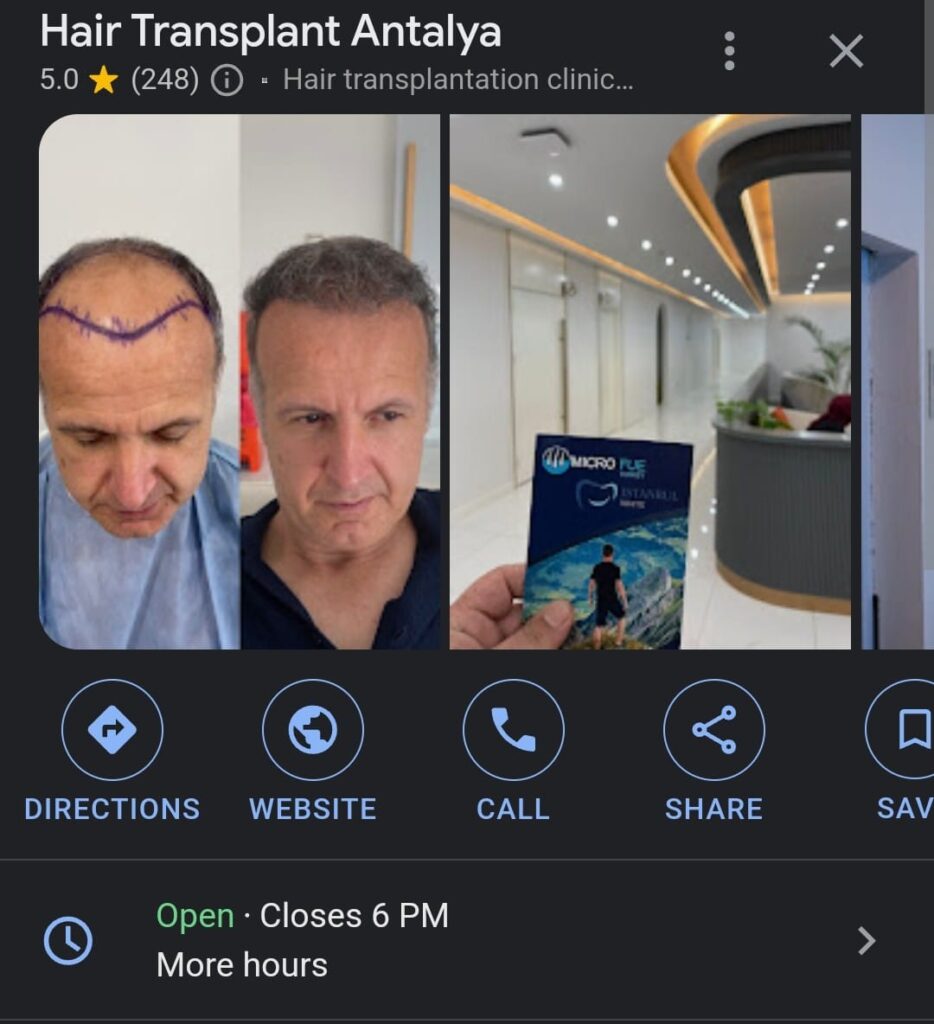 Best Hair Transplant Clinics in Alanya