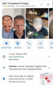Antalya The World's Undisputed #1 Hair Transplant Destination