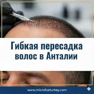 Пересадка волос в Анталии для пациентов из России