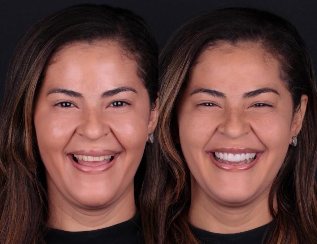 Dental treatment planning with dentists in Antalya