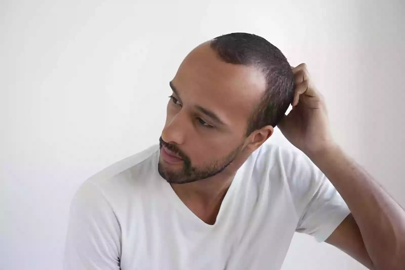 Planning a hair restoration trip
