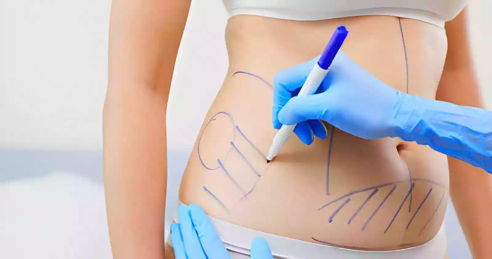 Body Aesthetics in Antalya and wellness