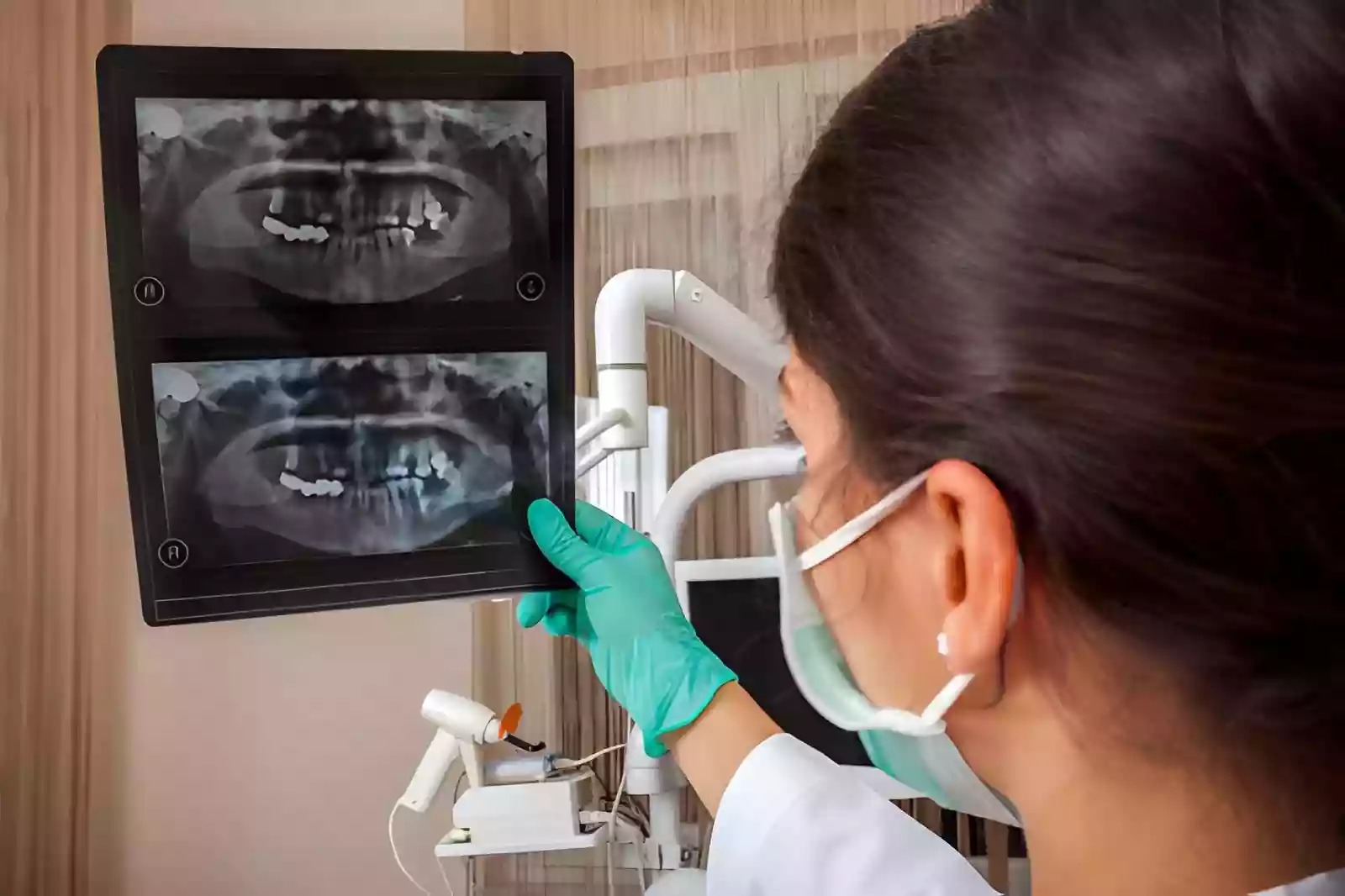 Digital Smile Design in Antalya Dental Clinic