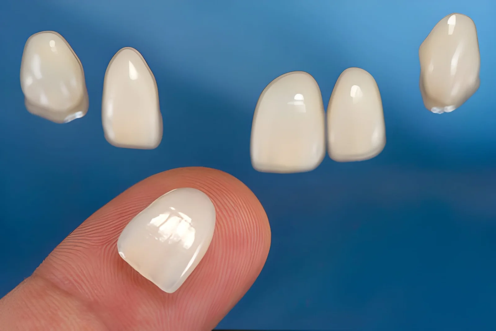 Laminate Veneers in Taksim