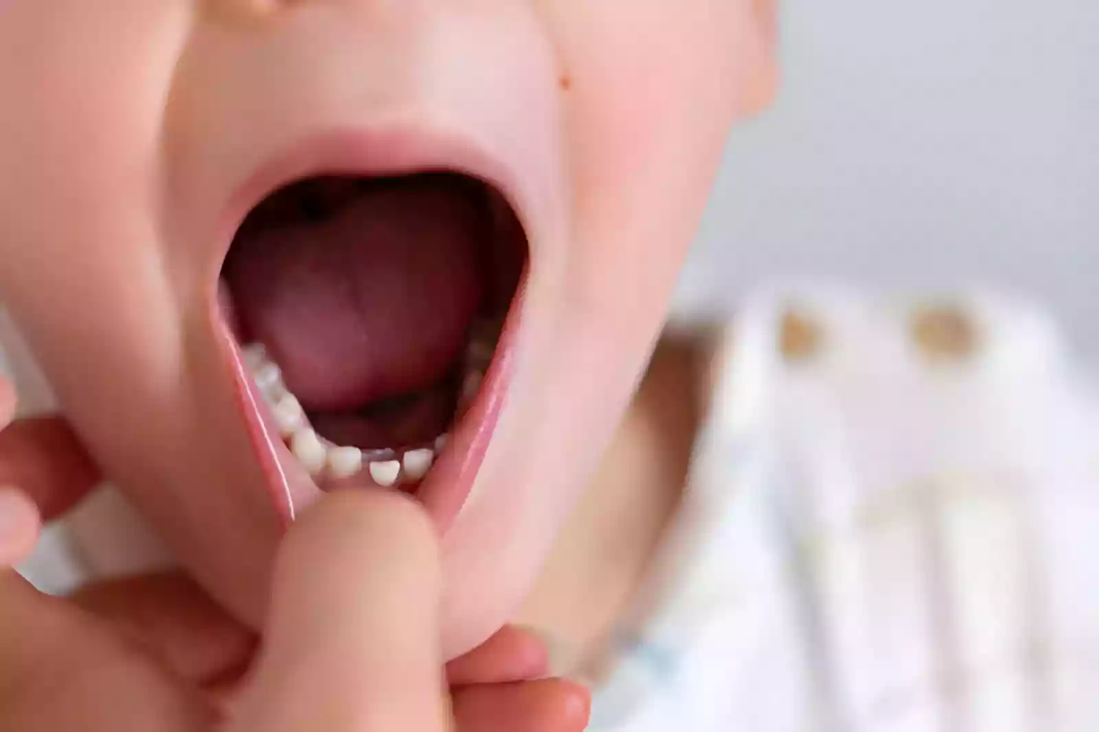 Dentist in Antalya discussing dental treatment options