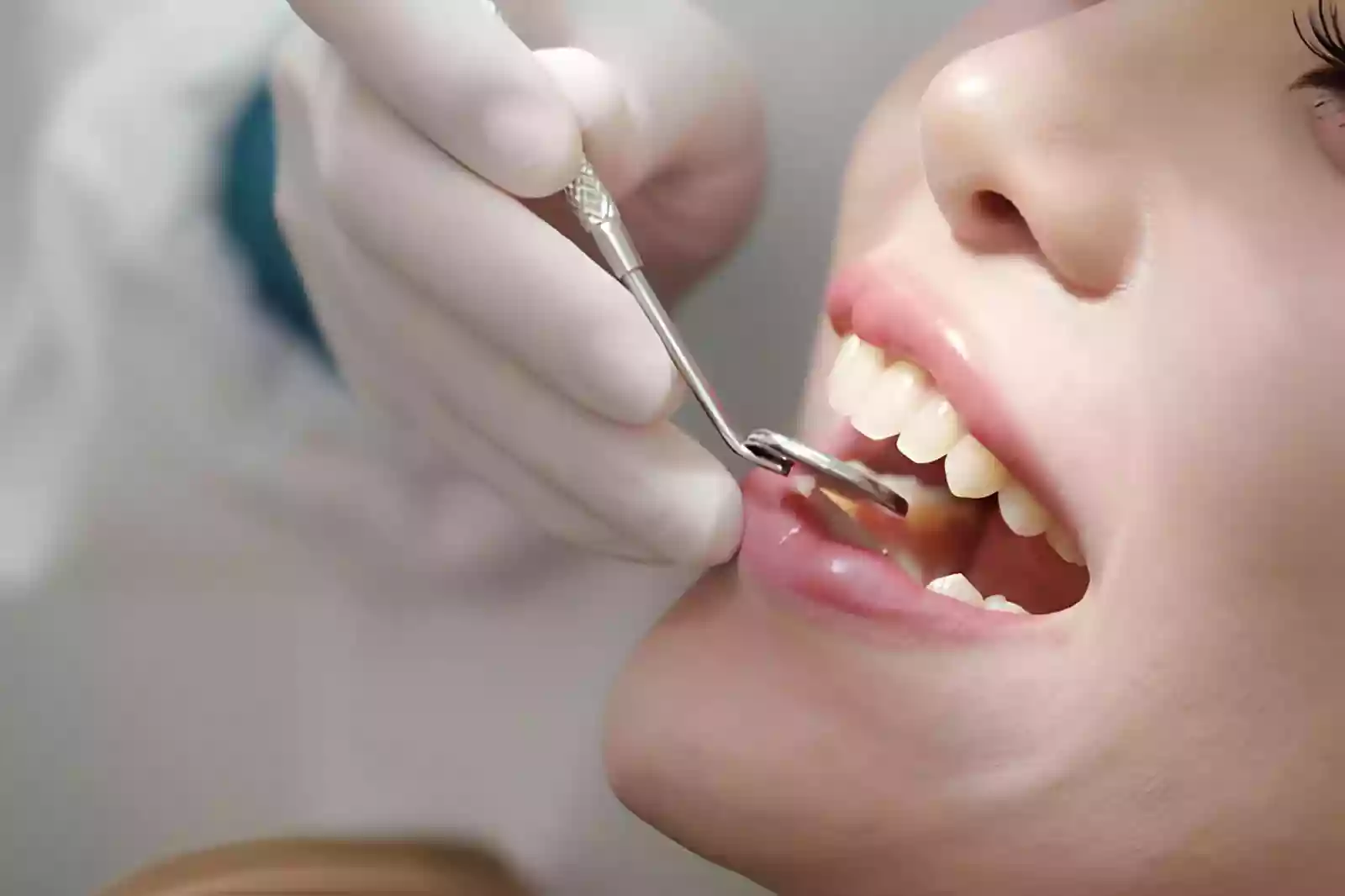 Dental treatment planning and cost discussion in Antalya Turkey