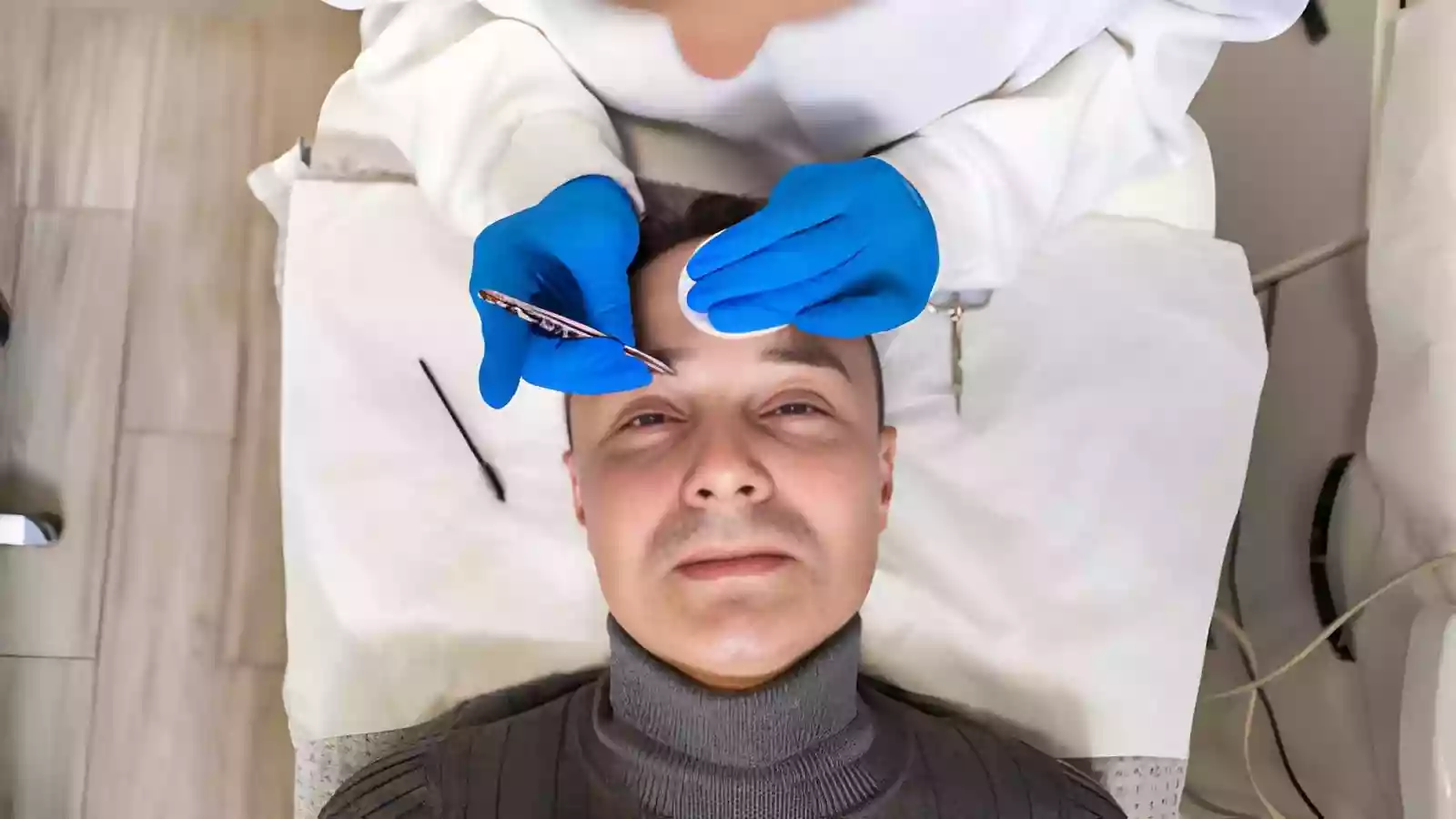 Eyebrow Transplantation in Antalya