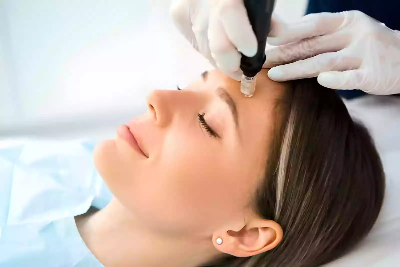Face Lift in Antalya facial rejuvenation