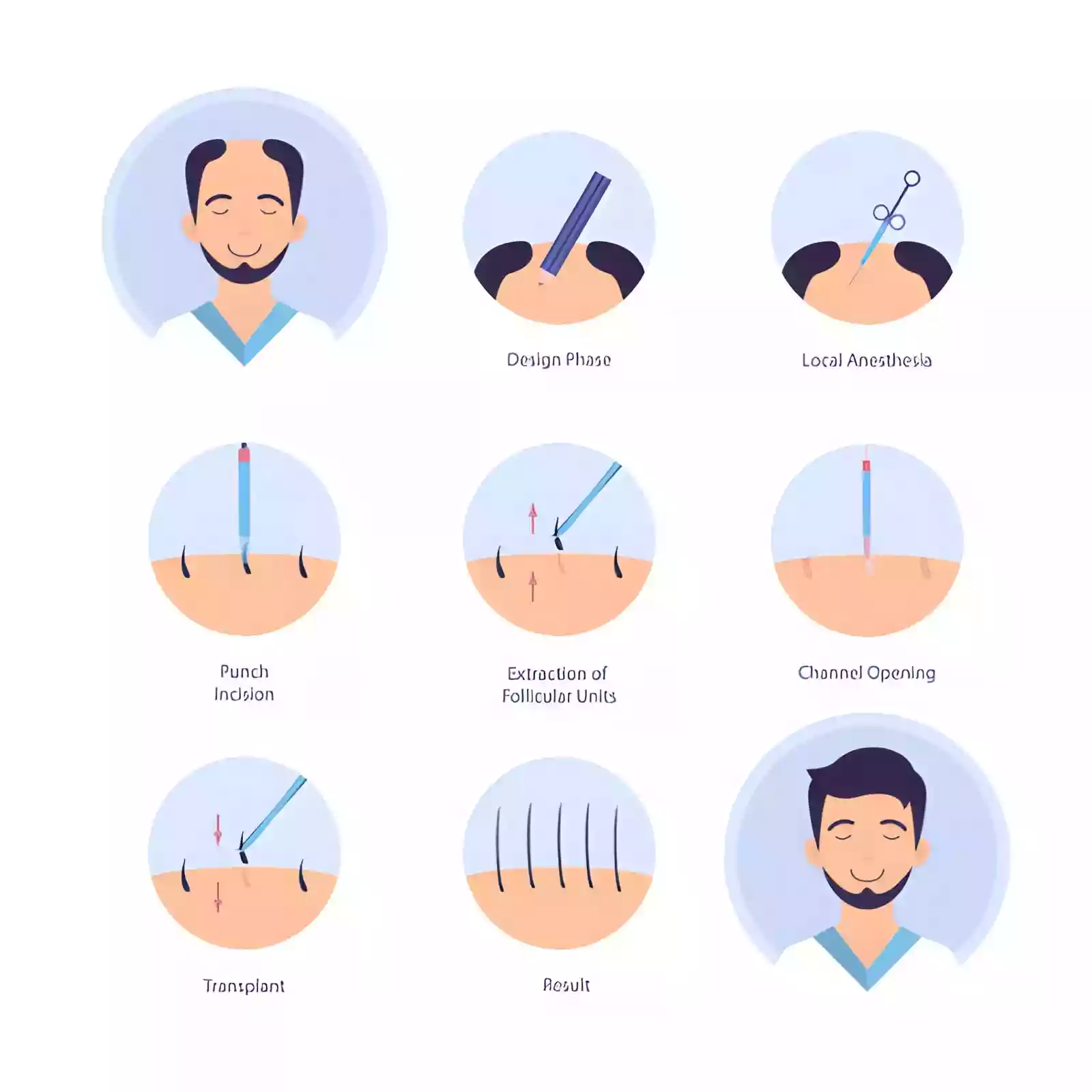 One-on-One Online Consultation Antalya for hair transplant planning