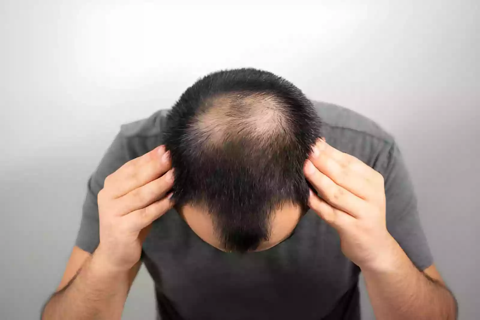 Online hair transplant consultation and preliminary hair loss assessment in Antalya