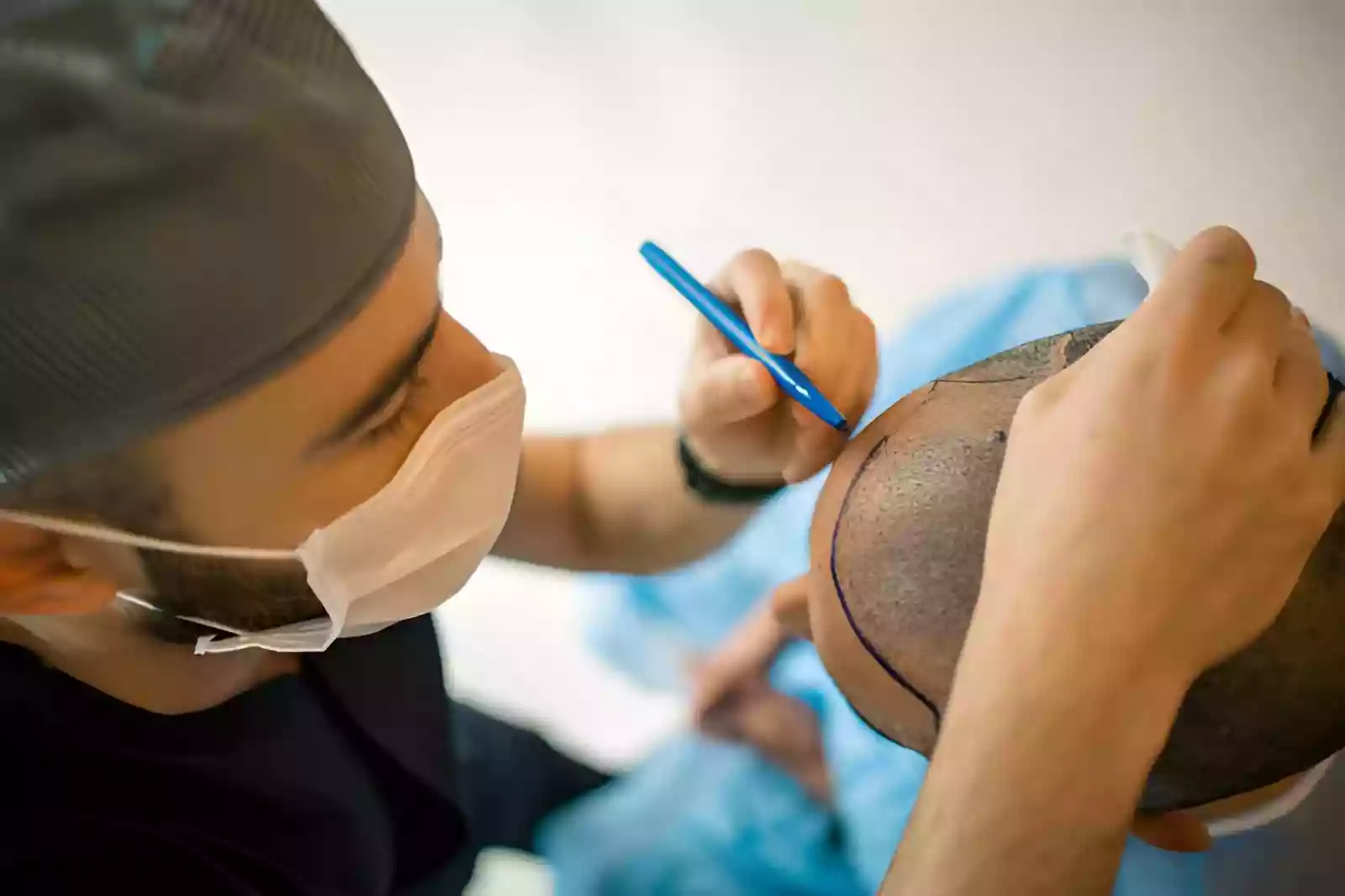 Session planning for PRP Hair Treatments in Antalya