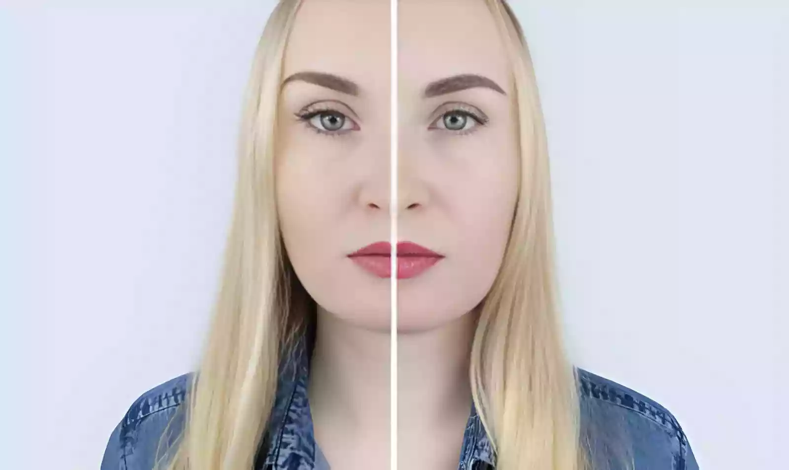 Eyebrow transplant before and after results natural brow line density