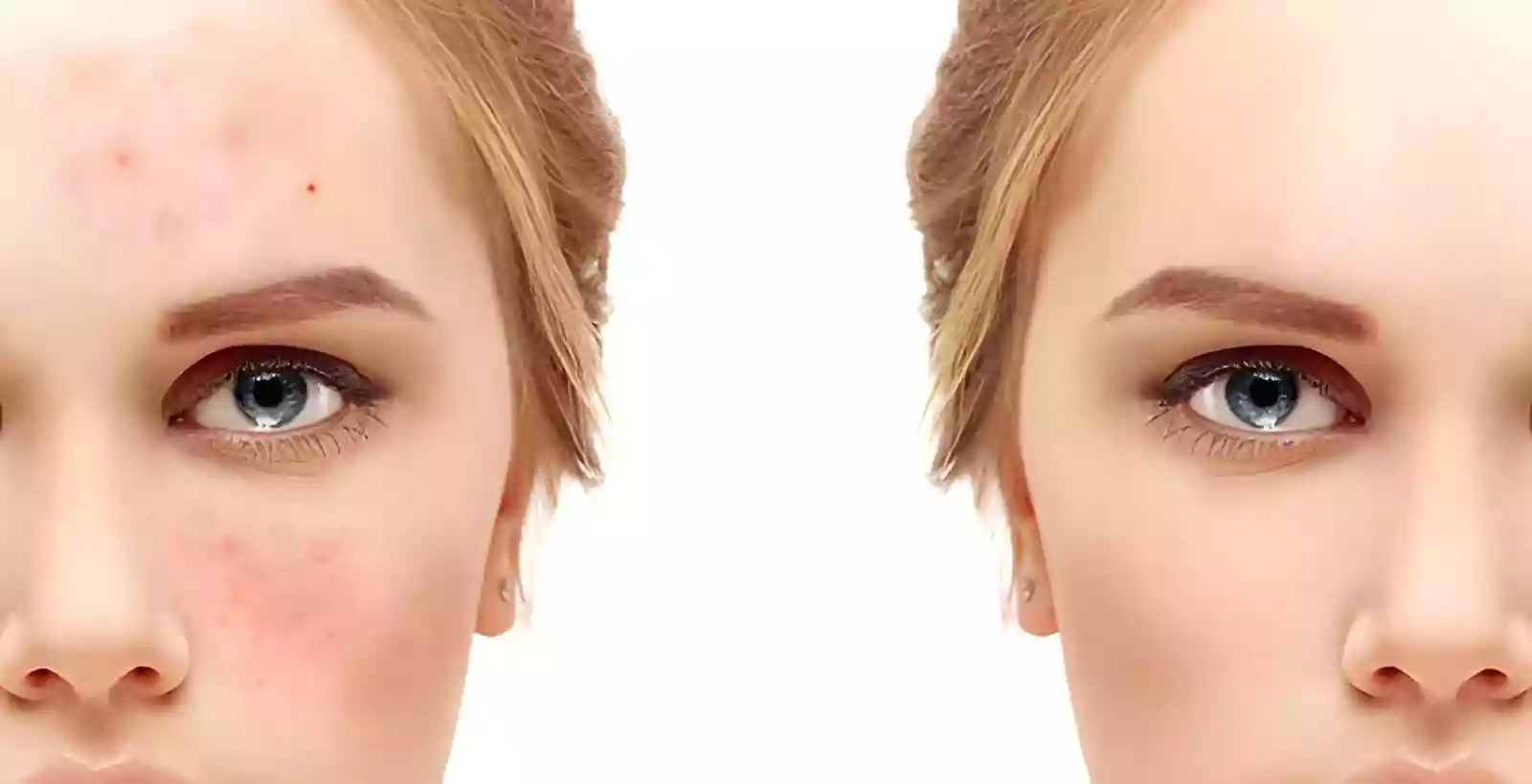 Eyebrow Transplant Healing & Aftercare Guide