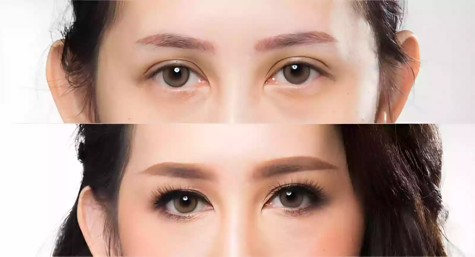 First 10 days post op healing in eyebrow transplant before and after results